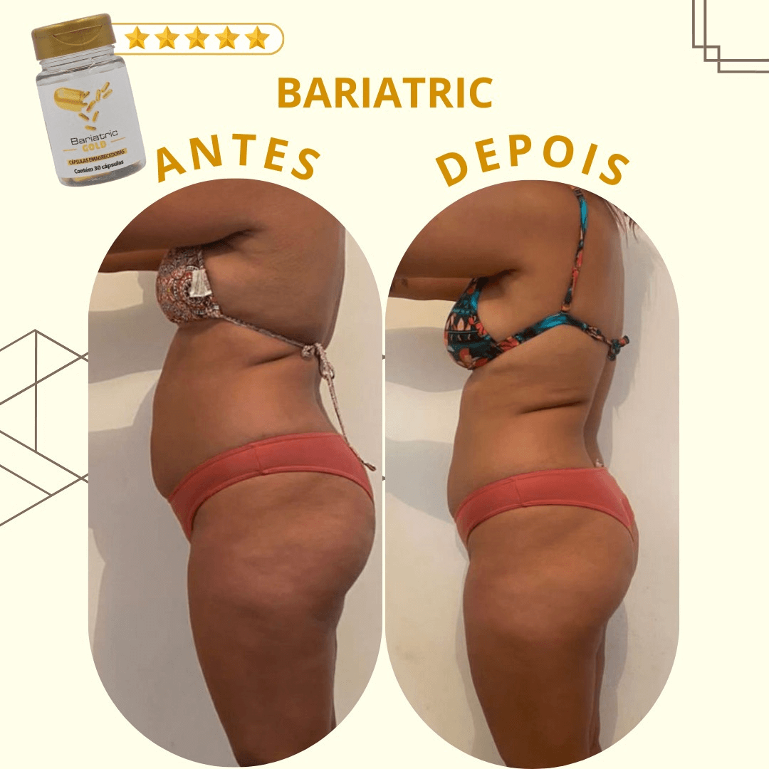 Bari 1